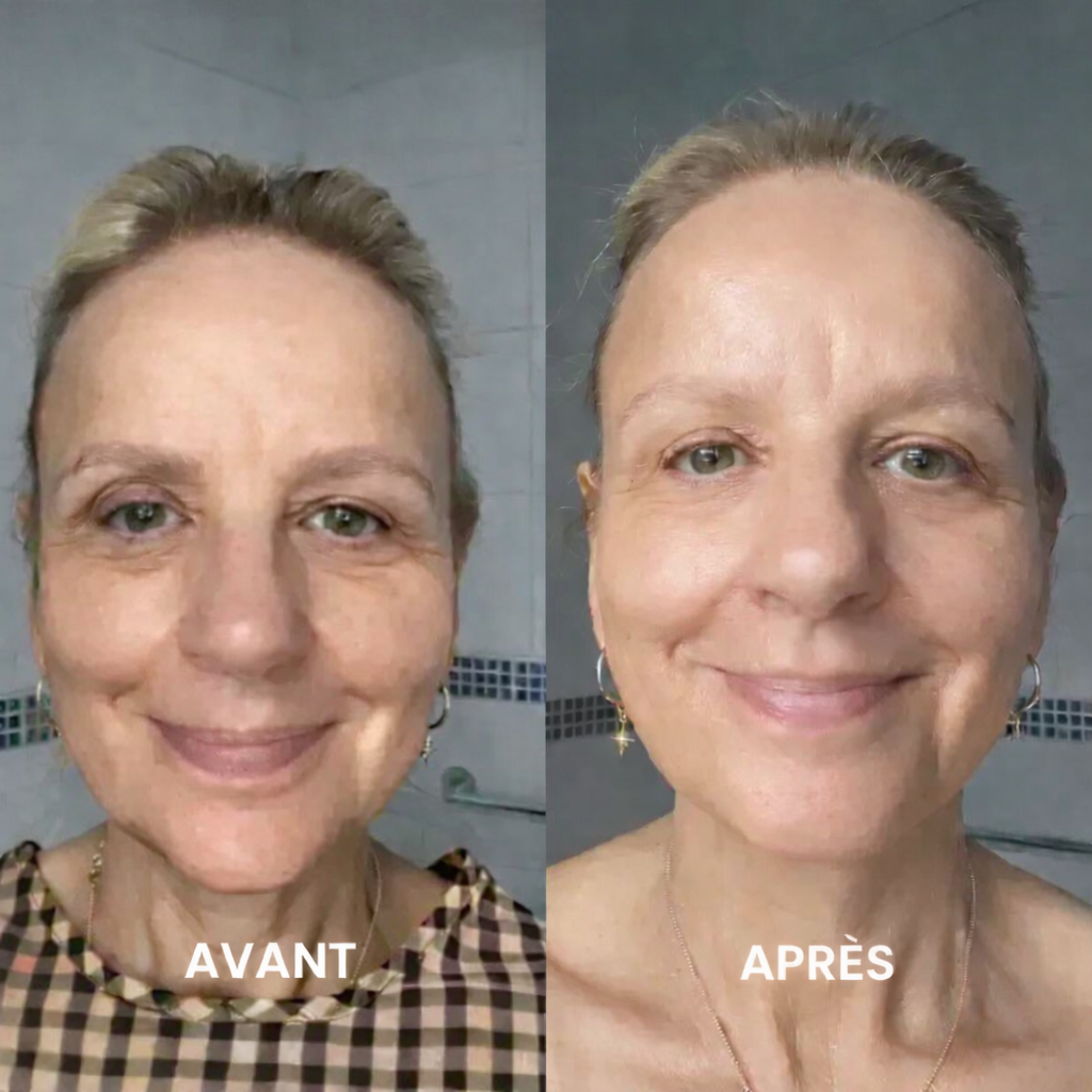 Coréeskin™ - 30ml Rajeunissement Éclatant